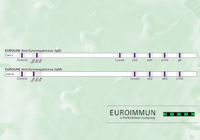 Nový produkt: EUROLINE Anti-Cytomegalovirus (IgG, IgM)